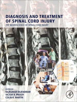 cover image of Diagnosis and Treatment of Spinal Cord Injury